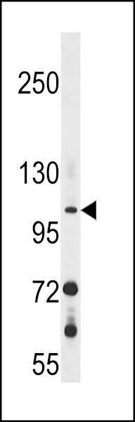 GUCY2F Antibody