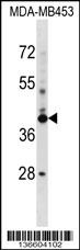 SRRD Antibody