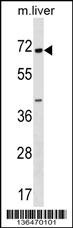 CPNE6 Antibody