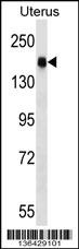 CGNL1 Antibody