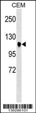 ATXN7 Antibody