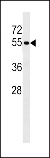 PTPN18 Antibody