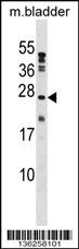 PTP4A1 Antibody