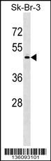 PAPD7 Antibody