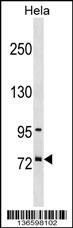 SUGP1 Antibody