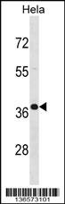 PABPN1 Antibody