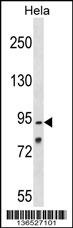 OSBPL1A Antibody