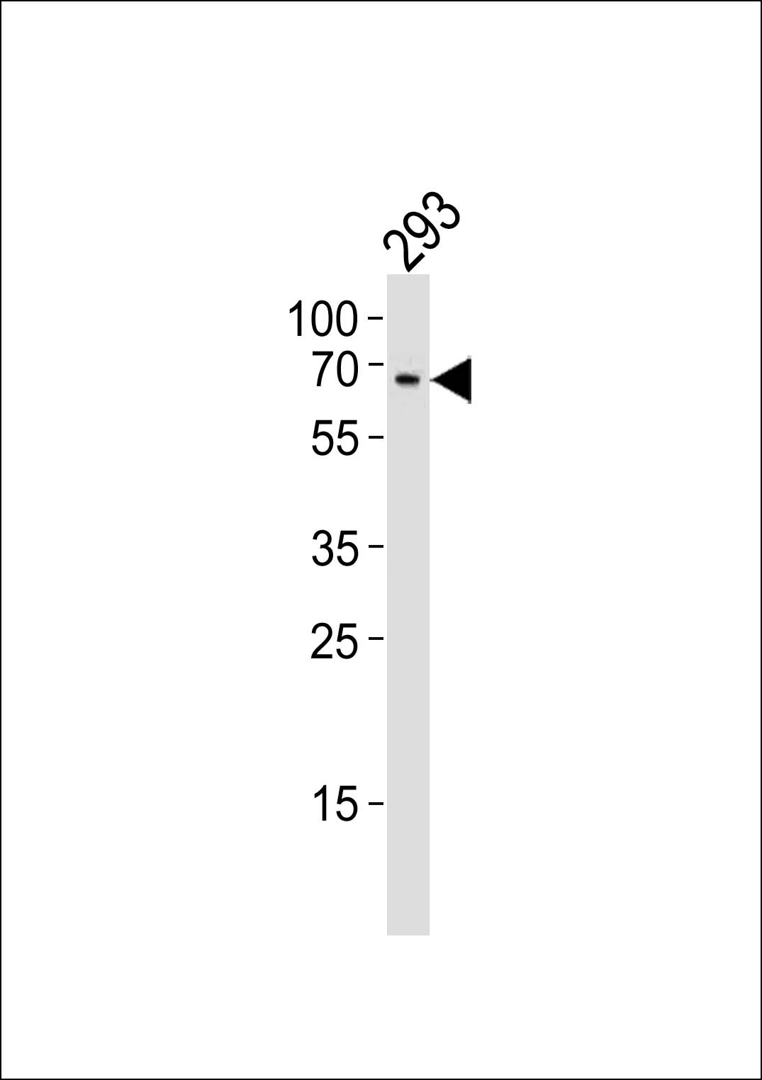 TESK1 Antibody