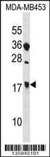 SIT1 Antibody