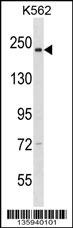 NCAPD3 Antibody