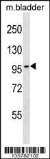 TOP3B Antibody