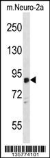 ZDHHC8 Antibody