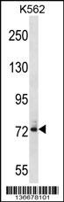 DNAI1 Antibody