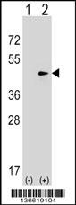 SEPT2 Antibody