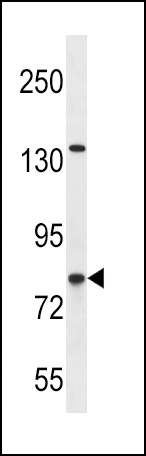 CPT1B Antibody