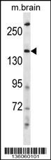 HECW2 Antibody