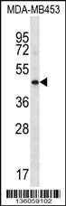 HAPLN3 Antibody