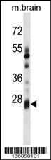 KCTD6 Antibody