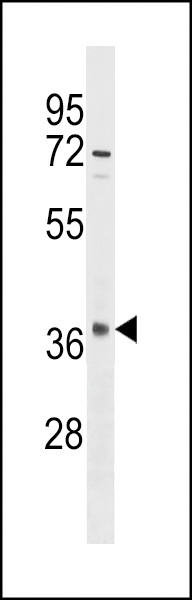 OR10S1 Antibody