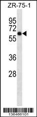 ARSD Antibody