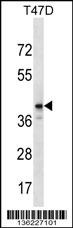 ZNF124 Antibody