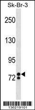 ZNF263 Antibody