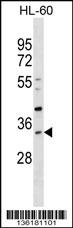 SULT1B1 Antibody