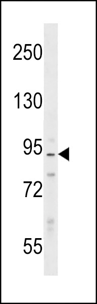 PPP1R9B Antibody