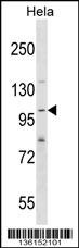 SH3PXD2A Antibody