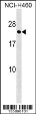 RAB41 Antibody