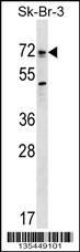 Mouse Bmpr1a Antibody