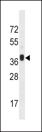 MNX1 Antibody