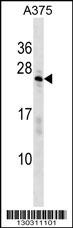 SARNP Antibody