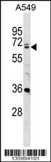 DDX28 Antibody