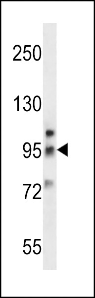 GRM6 Antibody