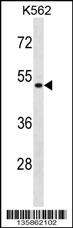 ENOSF1 Antibody