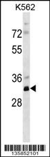 PRPS2 Antibody