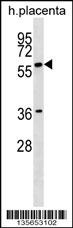 GAB3 Antibody