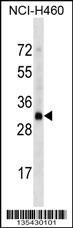 OR4D2 Antibody