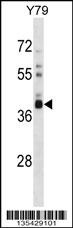 OR52L1 Antibody