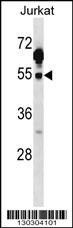 Csk Antibody