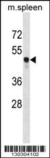 Csk Antibody
