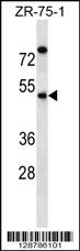 EME2 Antibody