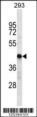HSDL2 Antibody