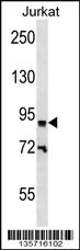 ZNF780B Antibody