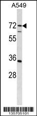 CDADC1 Antibody