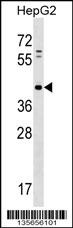 LPPR5 Antibody