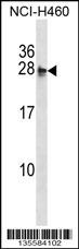 MOCS2 Antibody