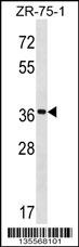 FUT7 Antibody