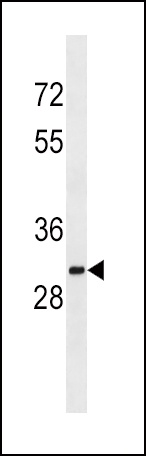 SULT1A2 Antibody